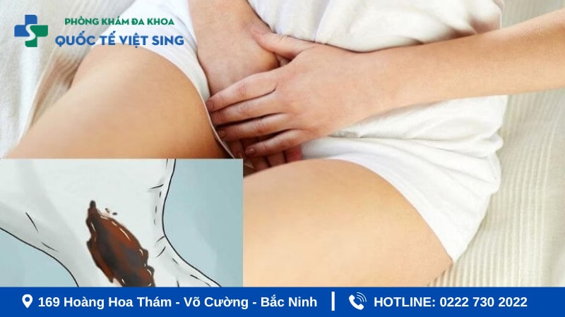 Viêm âm đạo ra khi hư có mầu nâu