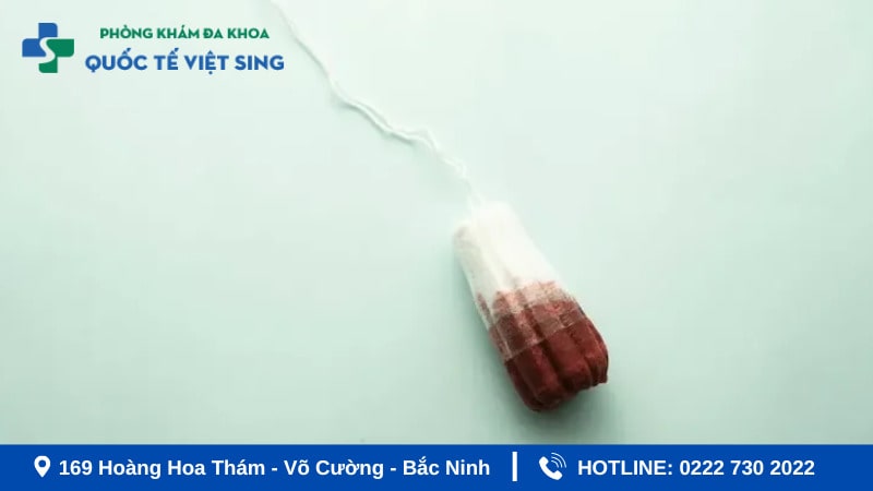 Yếu tố làm tăng nguy cơ khí hư màu nâu sau kỳ kinh