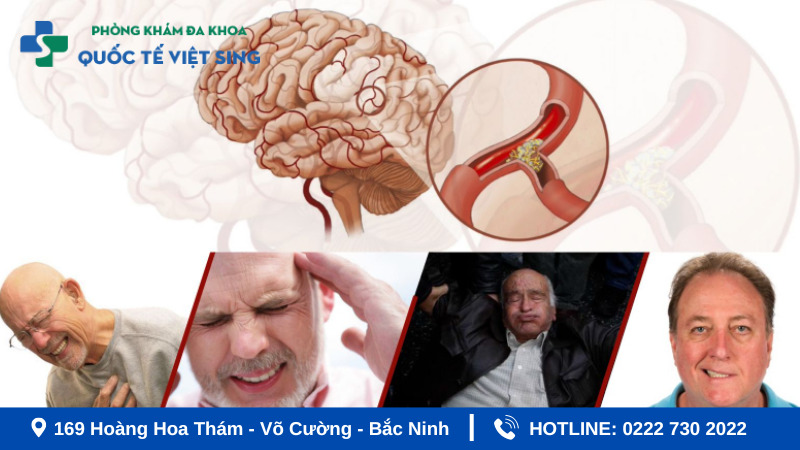 Biến chứng của tai biến mạch máu não