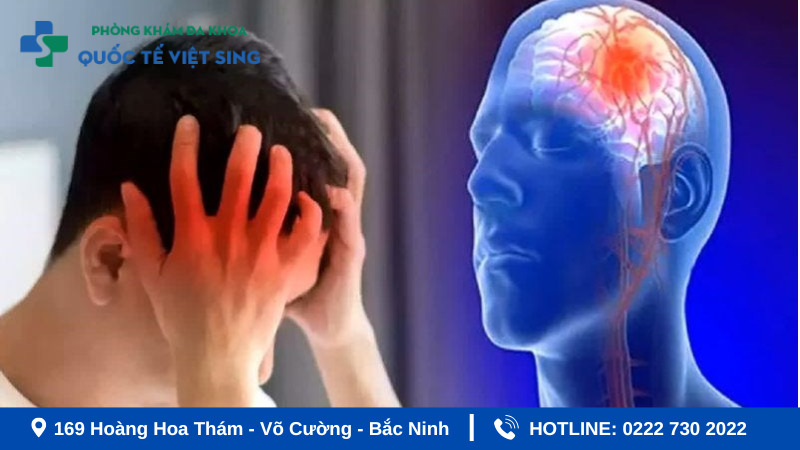 Hướng dẫn cách xử lý khi có dấu hiệu tai biến