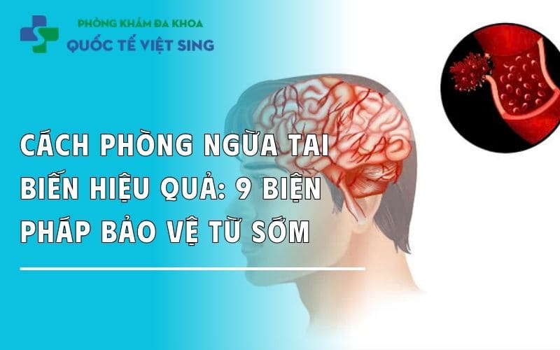 Cách phòng ngừa tai biến từ sớm: 9 Biện pháp giảm 80% nguy cơ