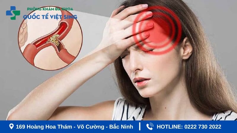 Biện pháp phòng ngừa tai biến (đột quỵ) hiệu quả