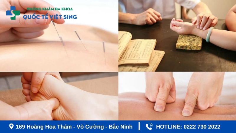 Hỗ trợ châm cứu phục hồi sau tai biến