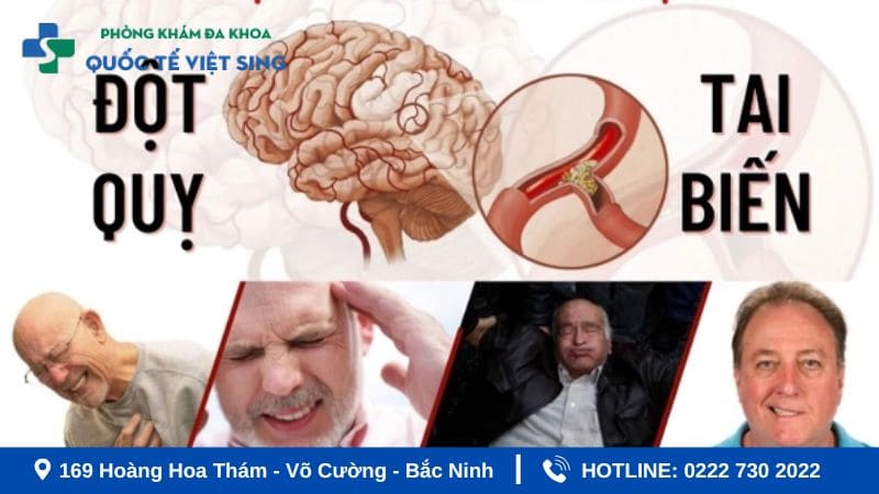 Nguyên nhân gây đột quỵ (tai biến mạch máu não) là gì?