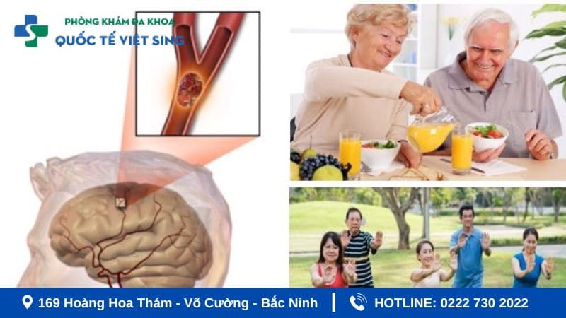 Vì sao cần phòng ngừa tai biến từ sớm?