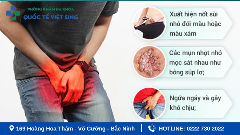 Khi nào cần xét nghiệm sùi mào gà?