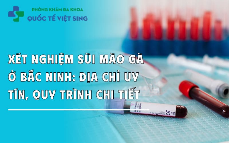 Xét nghiệm sùi mào gà ở Bắc Ninh: Địa chỉ uy tín, quy trình chi tiết