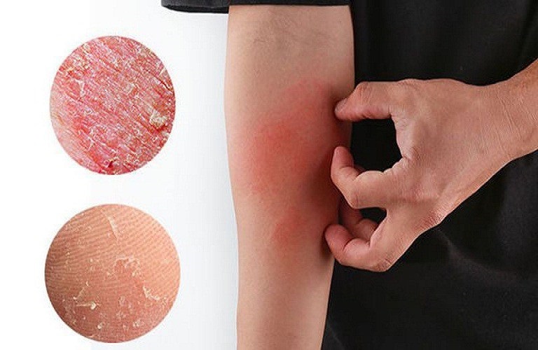 10+ Địa chỉ phòng khám da liễu ở Bắc Ninh, uy tín, nhiều người tới khám