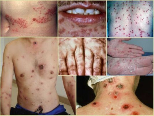 Phòng khám đa khoa quốc tế Việt Sing xét nghiệm bệnh xã hội