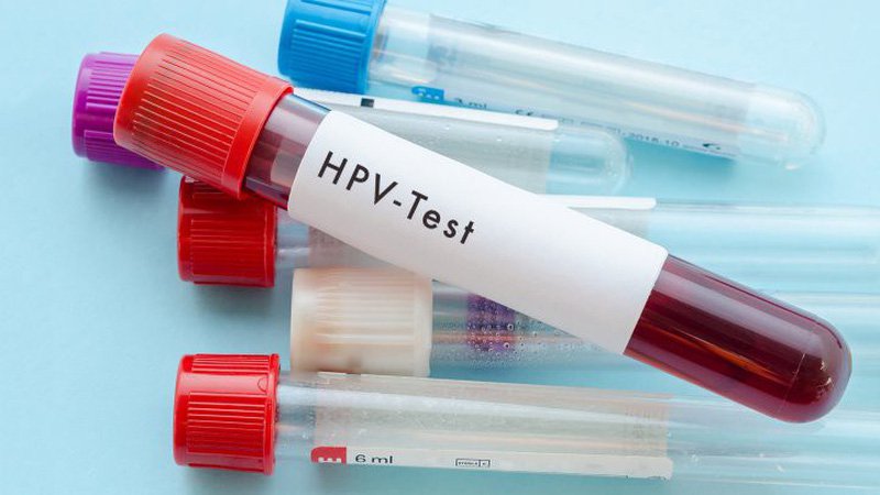 Phòng khám đa khoa quốc tế Việt Sing xét nghiệm HPV